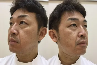 エコツー3日目。