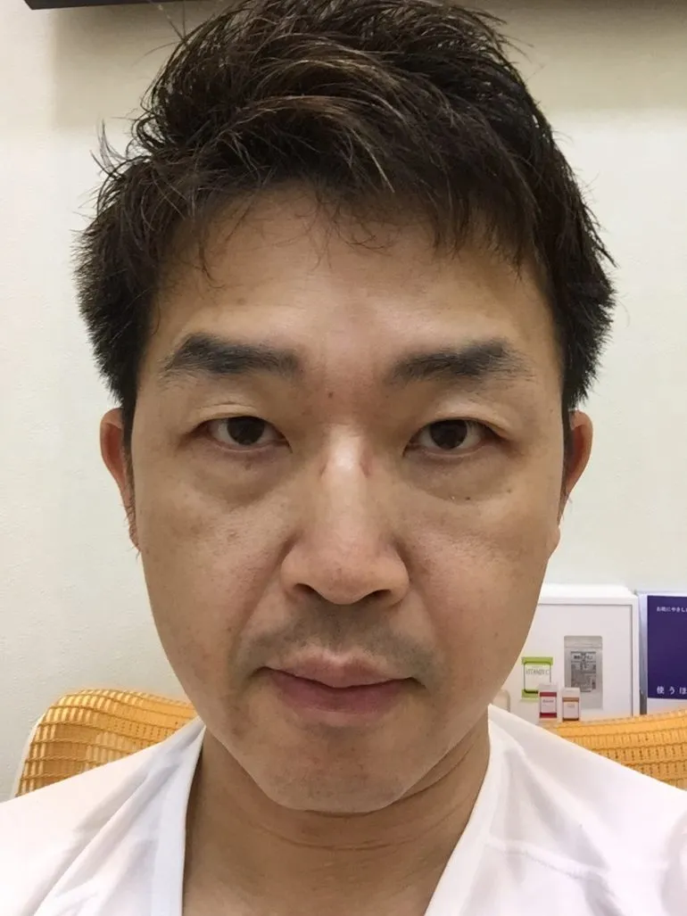 目元のクマには、ベビーコラーゲンでナチュラルに！