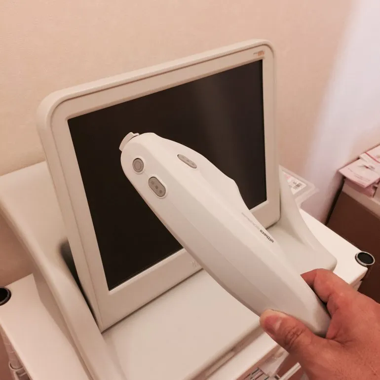 ウルセラリフトプラスでたるみに喝！